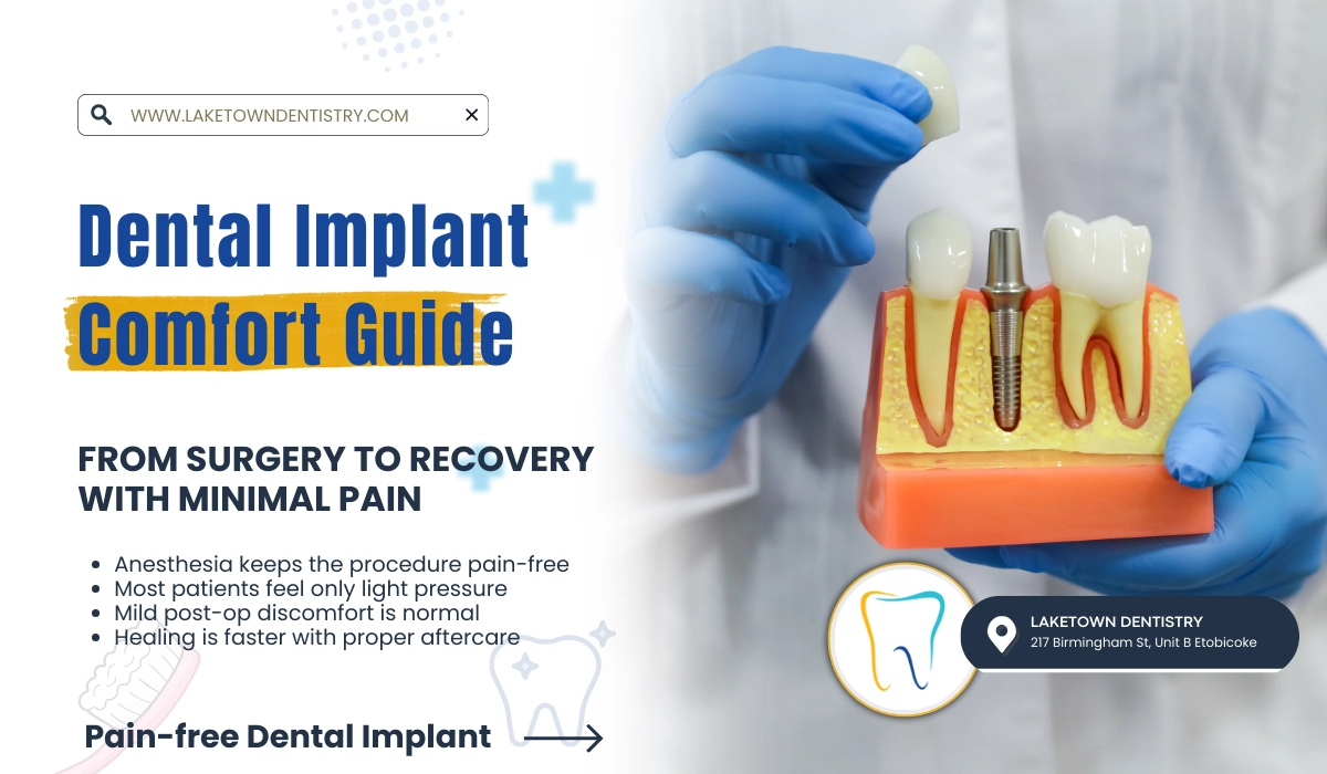 Dental Implant Comfort Guide